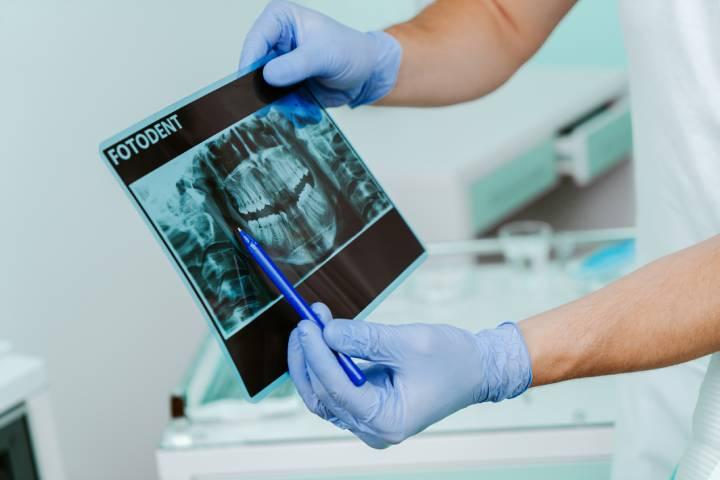 インプラントで金属アレルギーは起こる?原因とリスク、対処法を解説